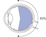 Optomap