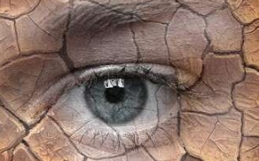 Dry Eye Clinic 0 Dry Eye Clinic